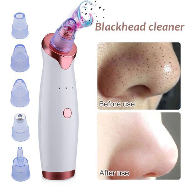 Blackhead-Remover-P11.jpg