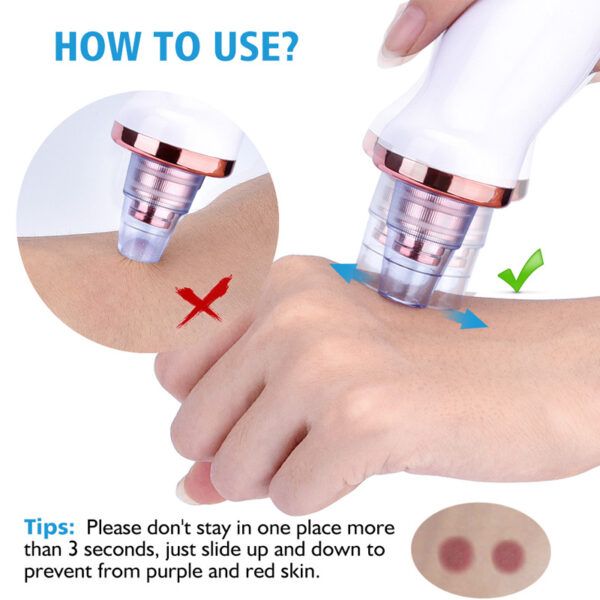 Blackhead-Remover-P5.jpg