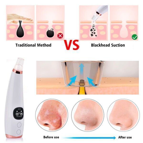 Blackhead Remover_0000s_0004_Layer 13.jpg