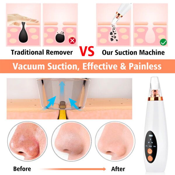 Blackhead Remover_0000s_0012_Layer 5.jpg